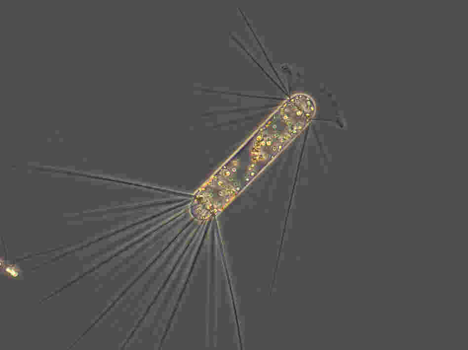 The diatom Corethron pennatum has spines like its related species Chaeotceros atlanticum and Chaeotceros dichaeta. However, this diatom consists of one cell while the other two are cell chains.