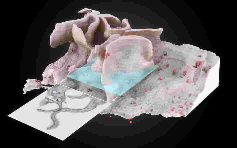 HIV particles (red spheres) pool in deep crevices on the surface of an immune cell. Some scientist think that HIV can move quickly around the immune system by hiding out in these nooks and crannies.