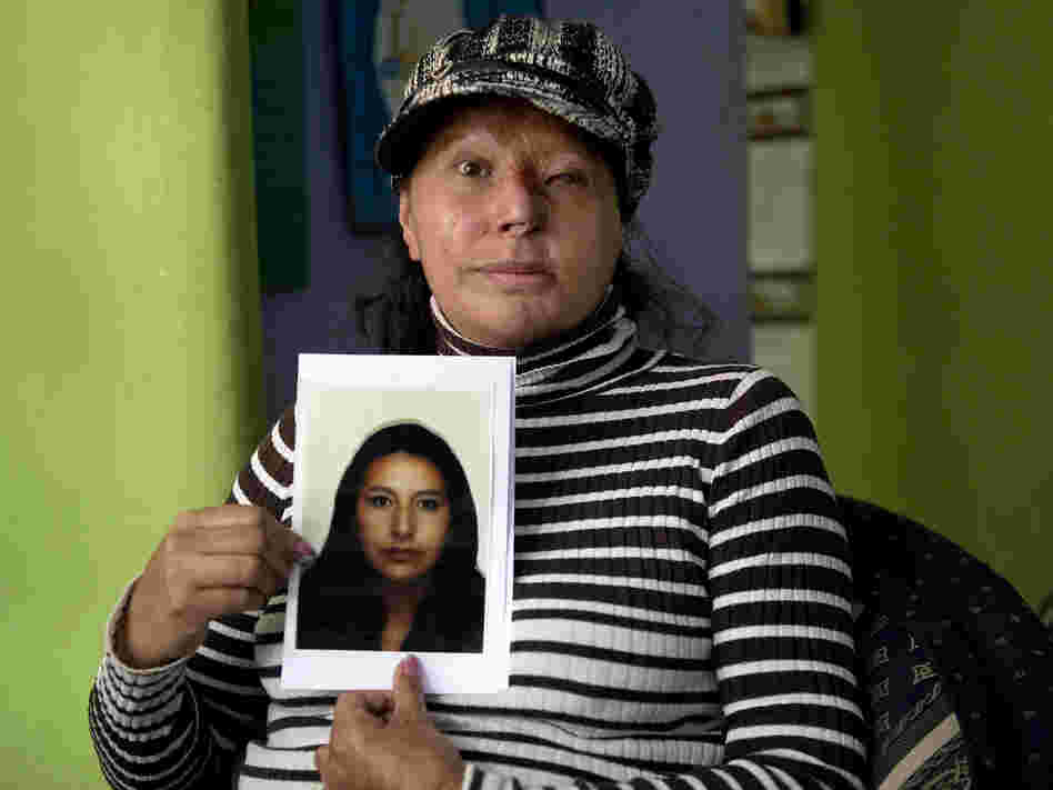 Maria Cuervo, 41, poses at her home in Bogota March 5 with a photo of herself before a stranger threw acid at her face in 2004.