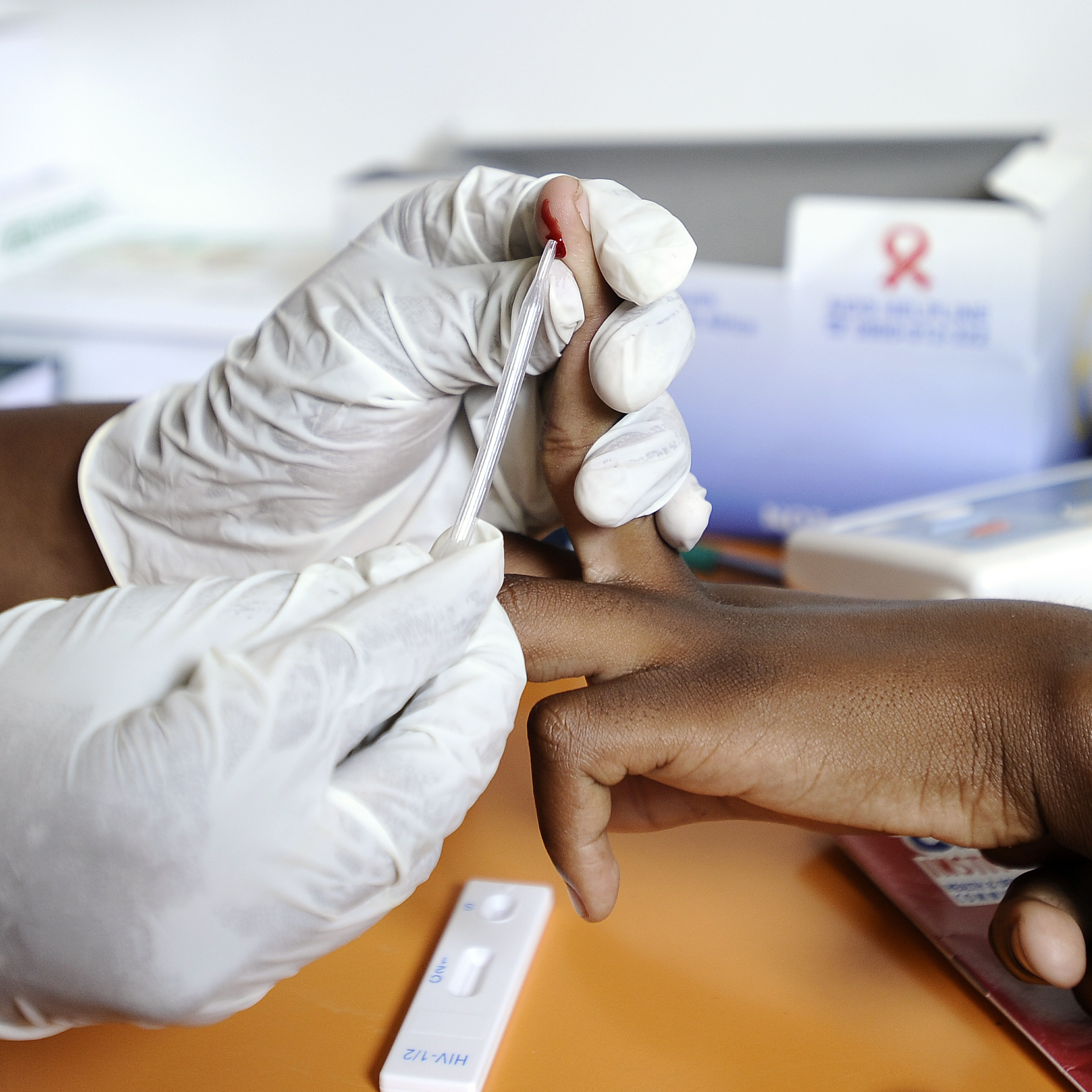 A drop of blood from a finger-prick is all that's needed to test for HIV. A nurse draws a sample from a student in a mobile clinic on March 8, 2011 in KwaZulu-Natal, South Africa.