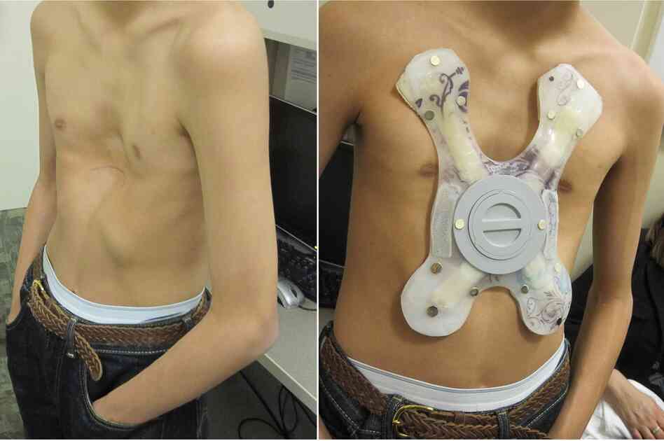 May Pull Kids With Sunken Chests Out Of Operating Room Shots