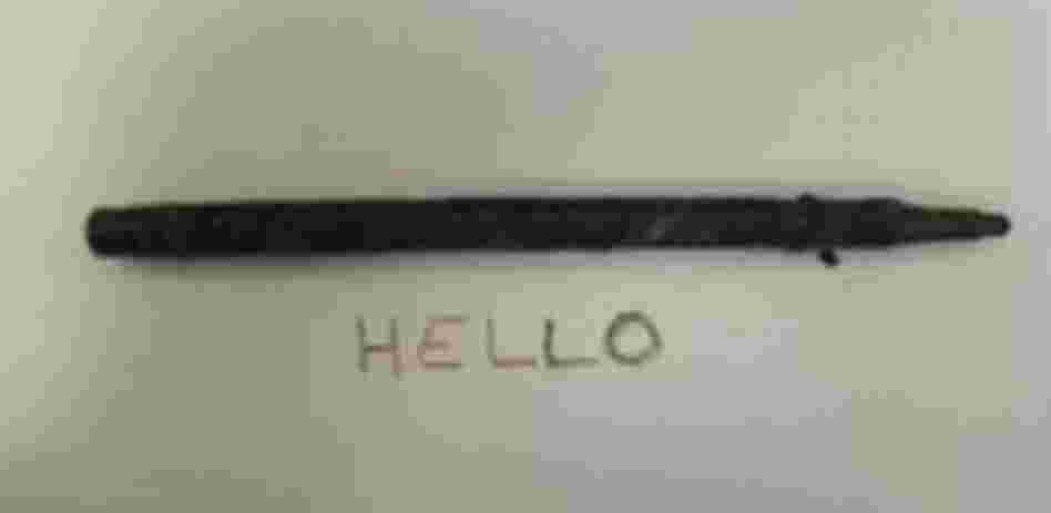 A felt-tipped pen removed from a woman's stomach after 25 years.