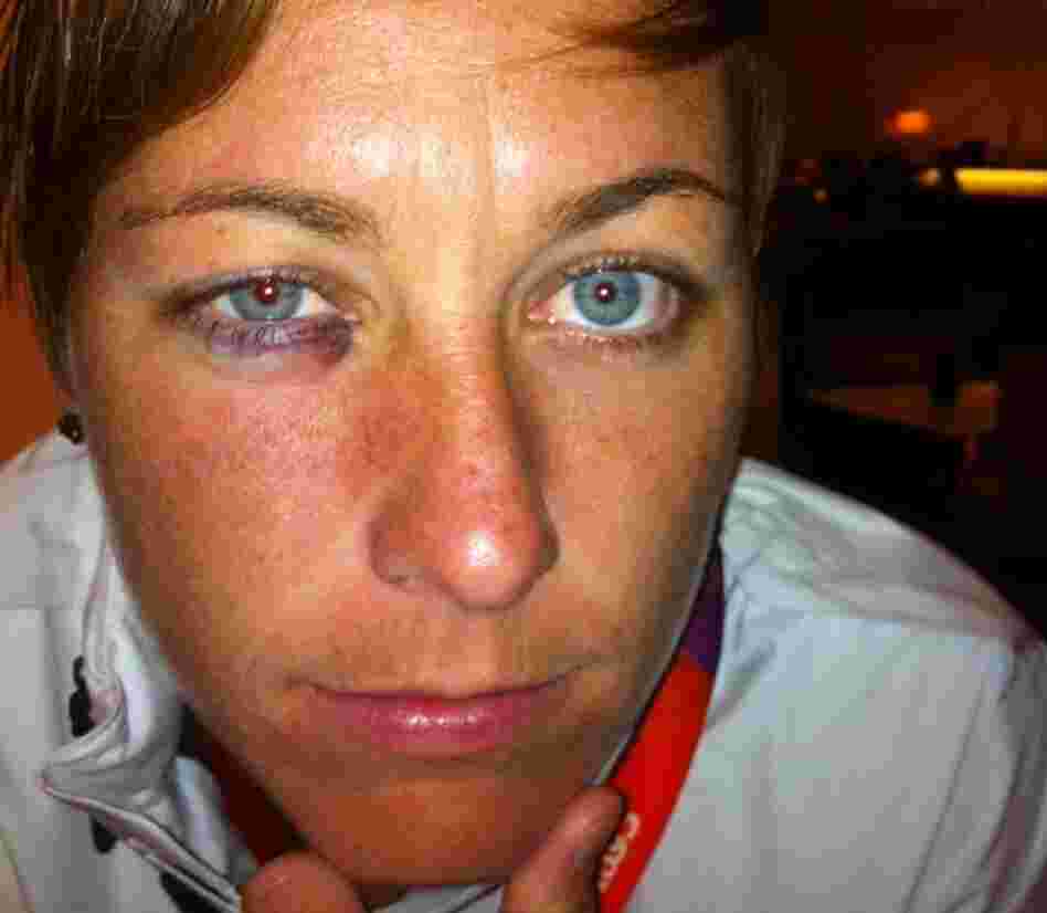 Abby Wambach after a game with Colombia. Abby Wambach after a game with Colombia.