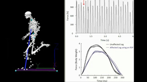 "The unaffected leg produces peak vertical forces that are on average 9 percent greater than those produced by the affected leg using a running-specific prosthesis," concluded scientists who studied a Paralympic sprinter. The sprinter ran on one prosthetic like that of Oscar Pistorius; his other leg was unaffected.
