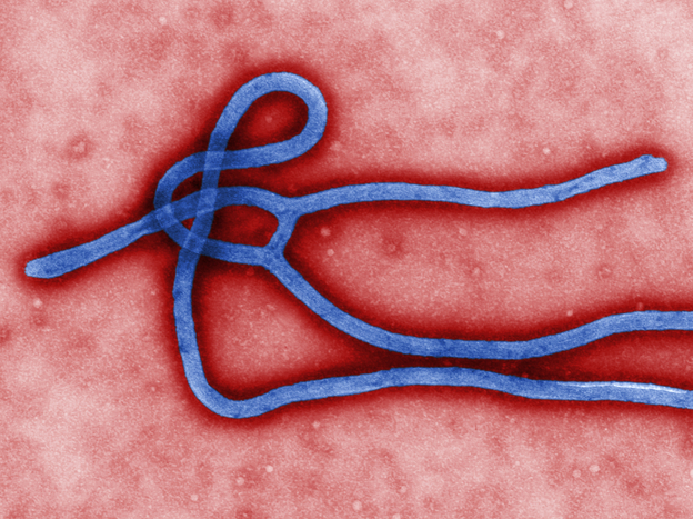 Although infections with the Ebola virus are rare, they can be deadly. (CDC)