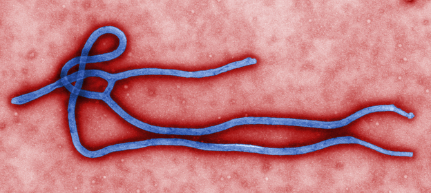 Although infections with the Ebola virus are rare, they can be deadly.