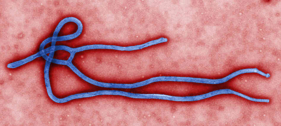 Although infections with the Ebola virus are rare, they can be deadly.