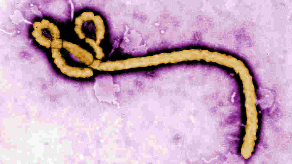 The Ebola virus causes a deadly form of hemorrhagic fever. The Ebola virus causes a deadly form of hemorrhagic fever.