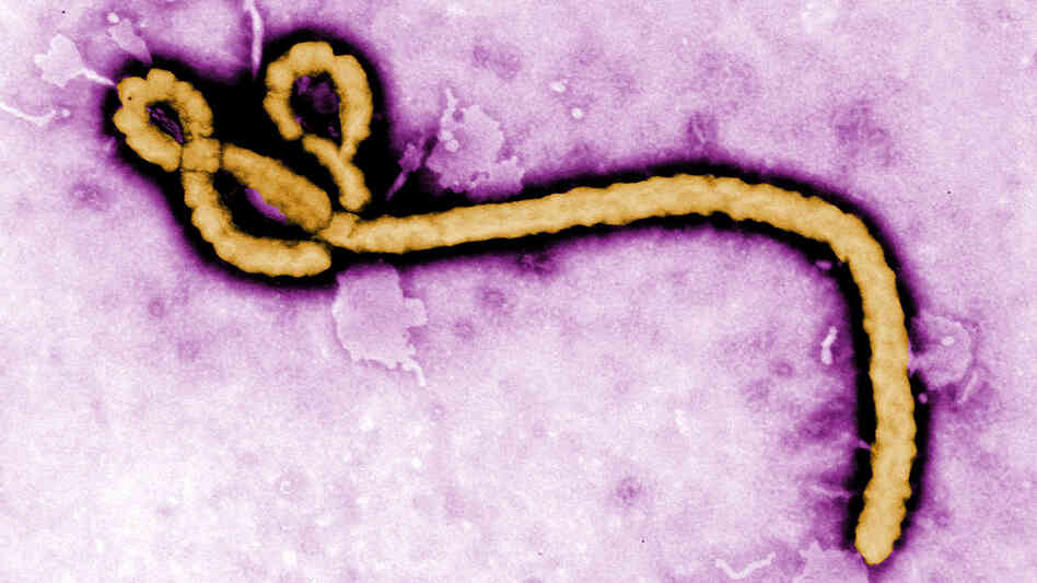 The Ebola virus causes a deadly form of hemorrhagic fever. The Ebola virus causes a deadly form of hemorrhagic fever.