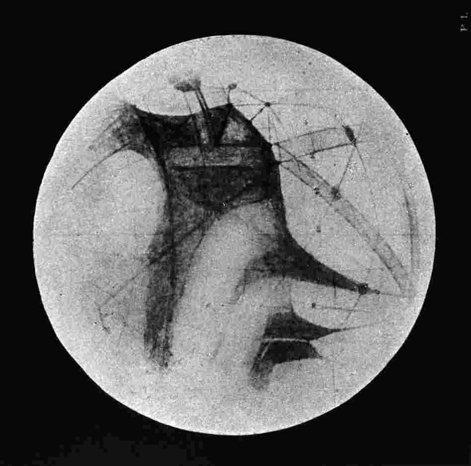 Percival Lowell's drawings of "canals" on Mars.