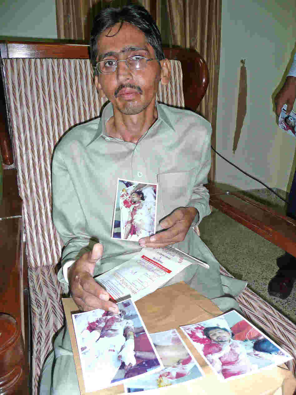 Mohammad Aslam Bhatti, 34, shares photos of himself taken after he was shot in the head, torso and arm by militants he says were motivated by Aamir Liaquat's TV program.