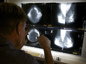 Radiologist Gerald Iba checks mammograms at The Elizabeth Center for Cancer Detection in Los Angeles in May 2010. Radiologist Gerald Iba checks mammograms at The Elizabeth Center for Cancer Detection in Los Angeles in May 2010.