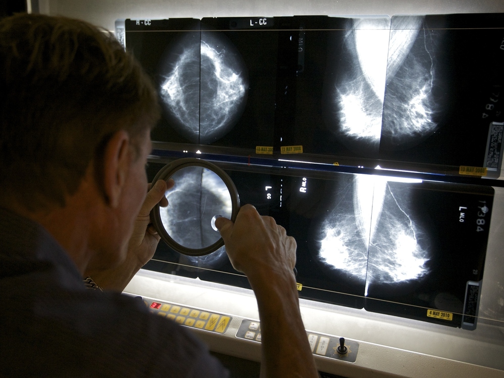 Radiologist Gerald Iba checks mammograms at The Elizabeth Center for Cancer Detection in Los Angeles in May 2010.