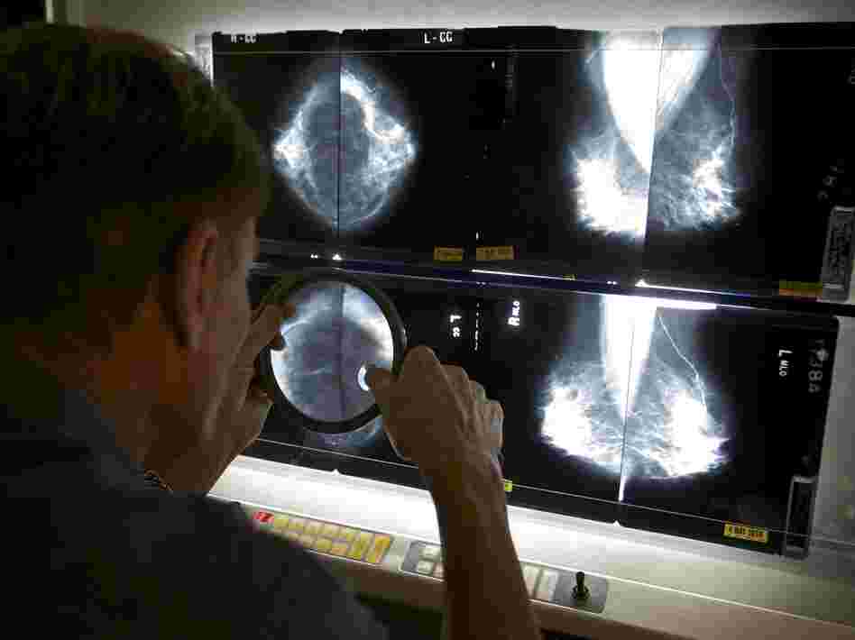 Radiologist Gerald Iba checks mammograms at The Elizabeth Center for Cancer Detection in Los Angeles in May 2010.