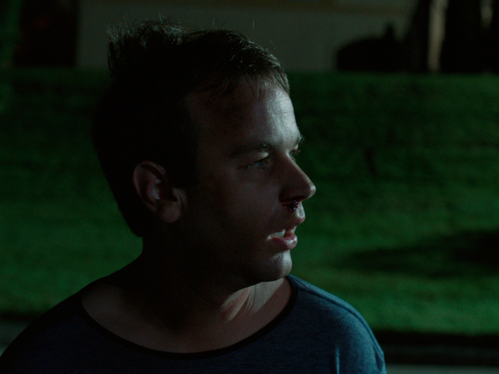 Matt often wakes up in places he doesn't remember venturing to — part of his REM behavior disorder.