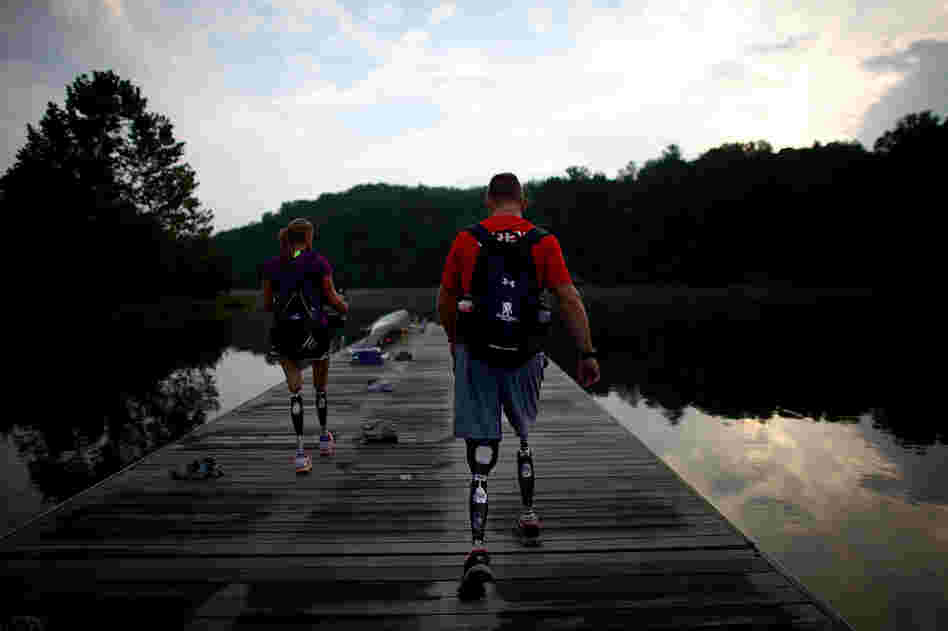 Masters was born with disfigured legs that were later amputated. 