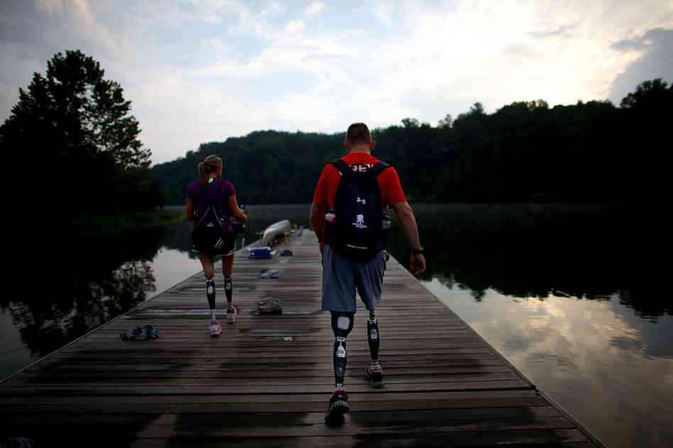 Masters was born with disfigured legs that were later amputated. 