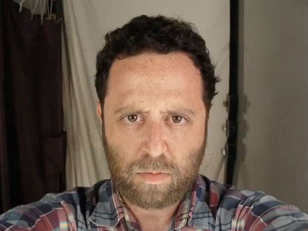 Noah's Face Is Now 6 1/2 Years Older