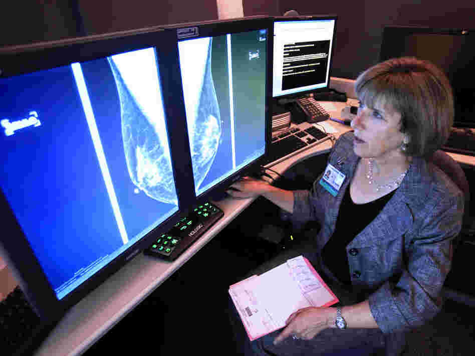 Dr. Karen Lindsfor, a radiologist at the University of California, Davis, Medical Center, reads a mammogram in Sacramento, Calif.