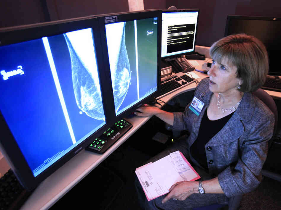 Dr. Karen Lindsfor, a radiologist at the University of California, Davis, Medical Center, reads a mammogram in Sacramento, Calif.