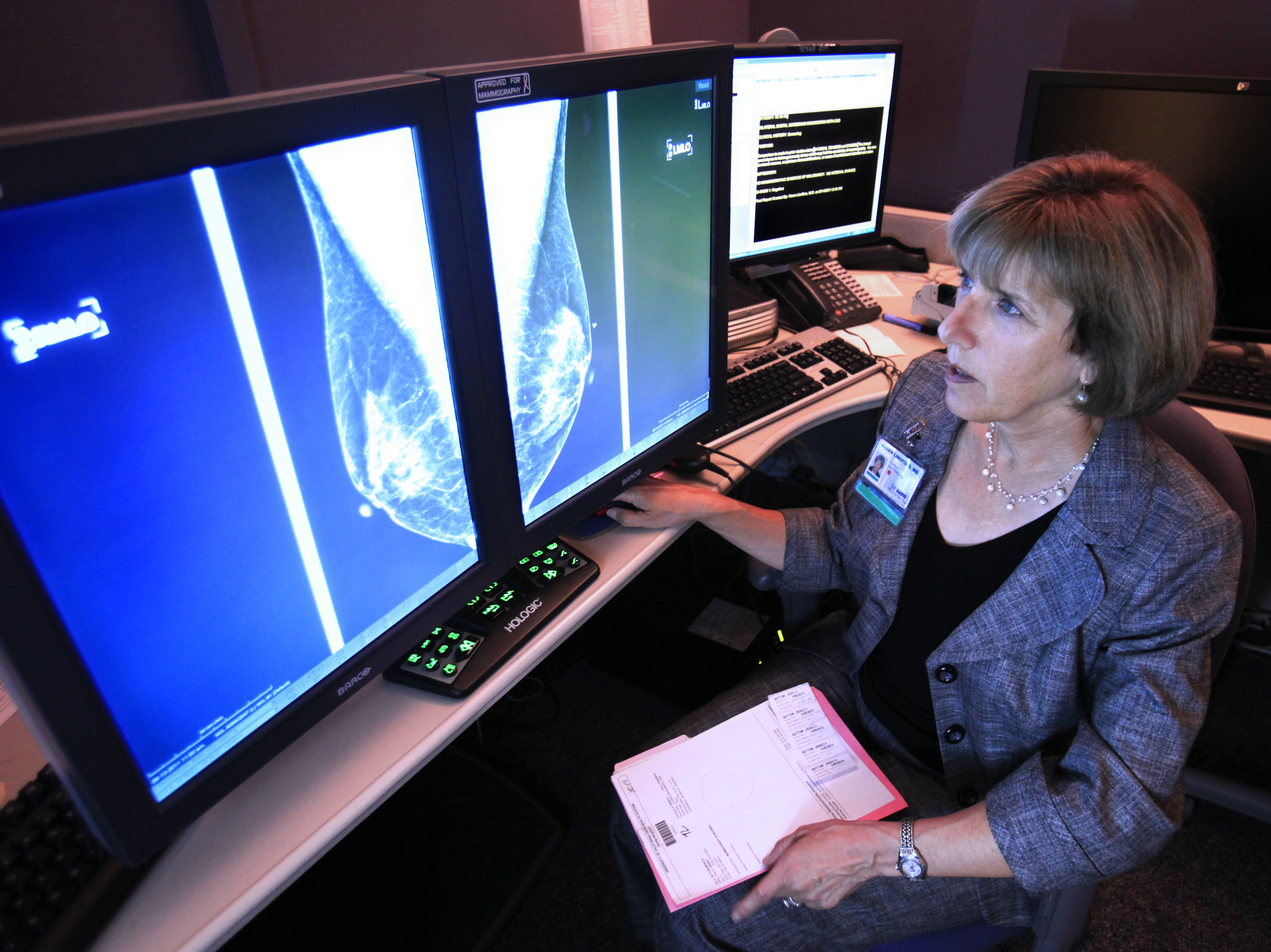 Dr. Karen Lindsfor, a radiologist at the University of California, Davis, Medical Center, reads a mammogram in Sacramento, Calif.