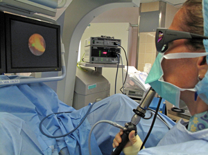 Dr. Dianne Sacco of Massachusetts General Hospital uses a laser ureteroscope to pulverize a kidney stone in Henry Owens. The screen shows a magnified image of the stone, an irregular yellow shape. Dr. Dianne Sacco of Massachusetts General Hospital uses a laser ureteroscope to pulverize a kidney stone in Henry Owens. The screen shows a magnified image of the stone, an irregular yellow shape.