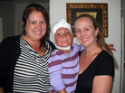 Arefa with her host family, sisters Jami Valentine (left) and Staci Freeman. Doctors in the U.S. have been treating Arefa's third-degree burns, and also performed skin-graft surgery for the top of her head. Each morning still requires a fresh dressing. Arefa with her host family, sisters Jami Valentine (left) and Staci Freeman. Doctors in the U.S. have been treating Arefa's third-degree burns, and also performed skin-graft surgery for the top of her head. Each morning still requires a fresh dressing.