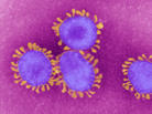 Different types of coronaviruses can cause a simple cold or a deadly respiratory illness, such as SARS. Different types of coronaviruses can cause a simple cold or a deadly respiratory illness, such as SARS.