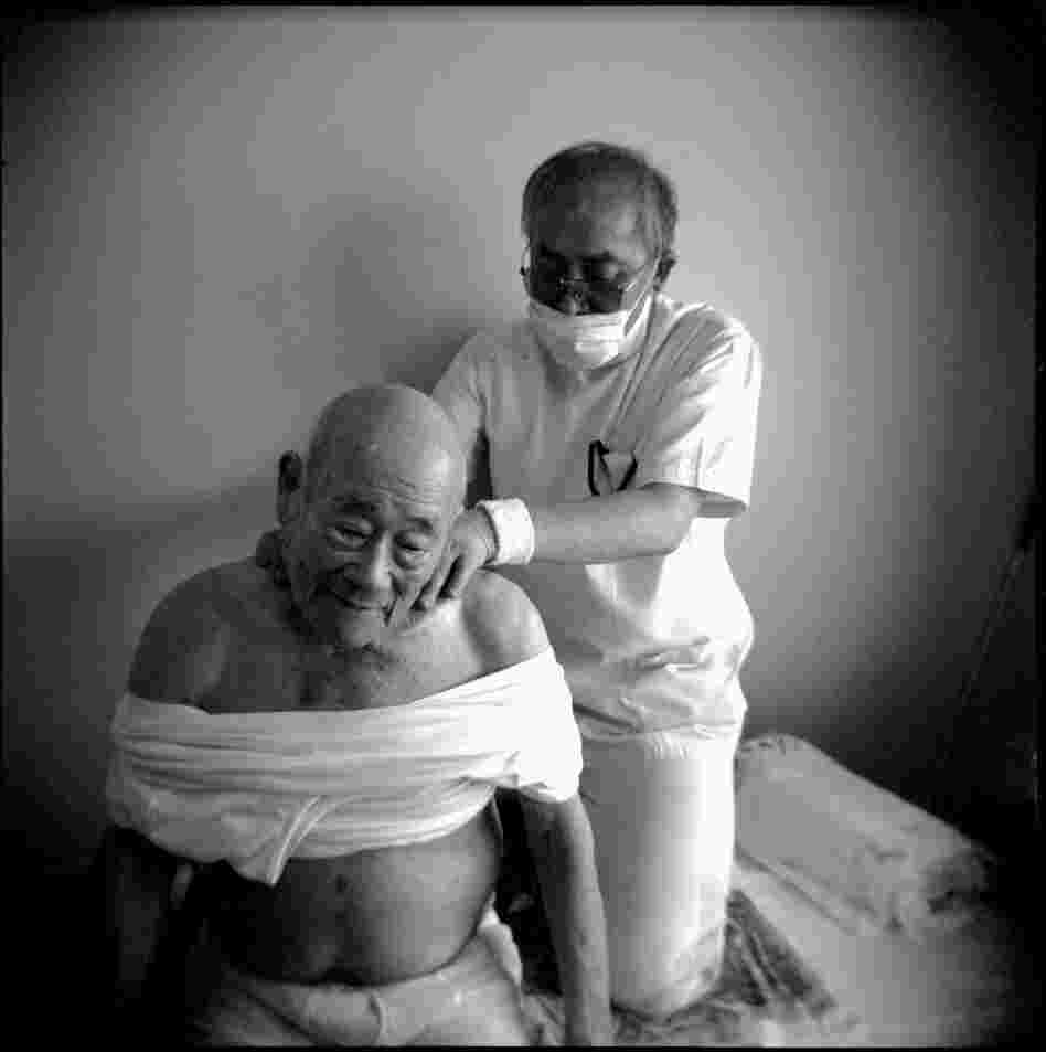 Miyata receives acupuncture and massage from Dr. Hidemi Yamaguchi. "I remember reading what happened days before in Hiroshima. I thought we were lucky not too many people were injured in my area. These feelings changed as I made my way towards Nagasaki. It started raining as I approached the city. Soon I started seeing disfigured, bloody people. The city was in flames — black smoke and rain."