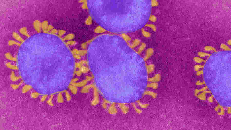 Coronaviruses get their name from the crown-like tentacles that surround their rims.