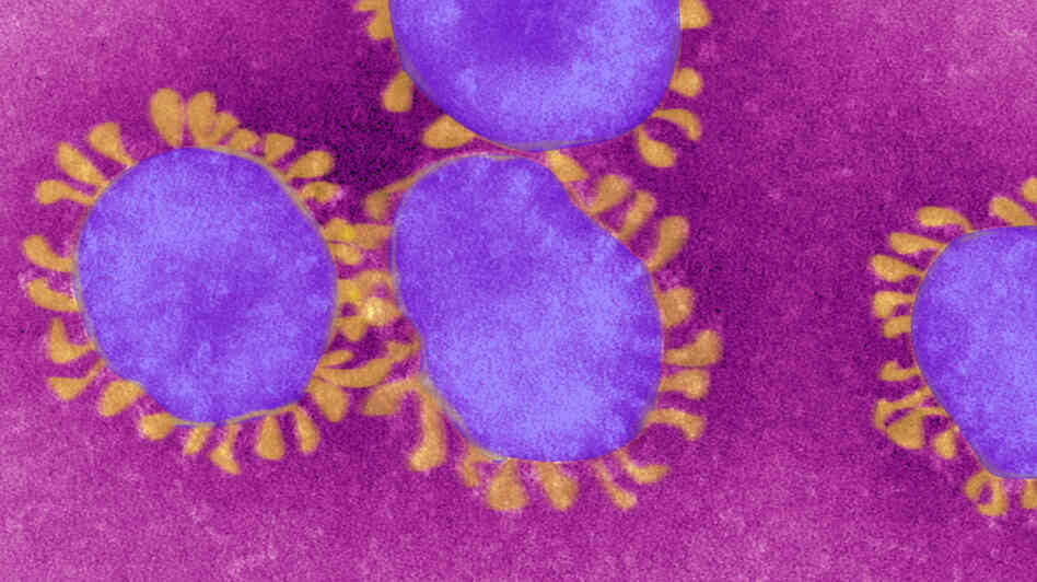 Coronaviruses get their name from the crown-like tentacles that surround their rims.