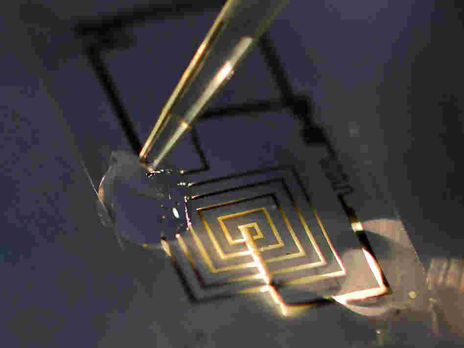 If these medical implants dissolve in the body, they could eliminate the need for surgery to retrieve them.