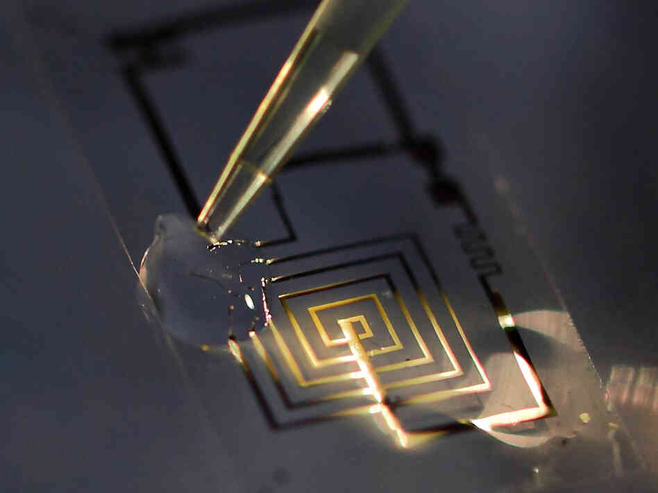 If these medical implants dissolve in the body, they could eliminate the need for surgery to retrieve them.