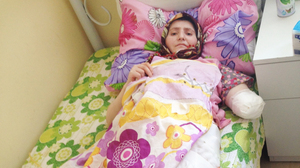 This 24-year-old Syrian woman from Homs was evacuated through the sewer system — which resulted in badly infected wounds — to a rehabilitation center in southern Turkey. She has had several surgeries to her abdomen and leg; her left arm was amputated.