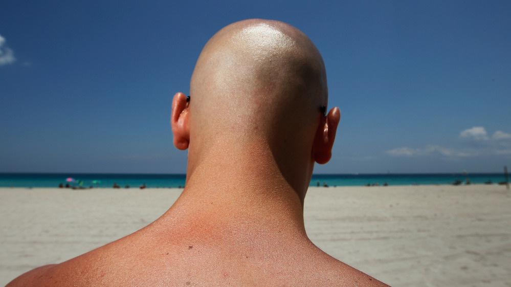 Stefano Amabili walks under the sun in Miami Beach, Florida, in May. The Center for Disease Control and Prevention has found that more people are using sunscreen and protecting themselves from the sun's rays.