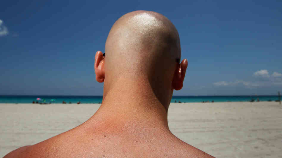 Stefano Amabili walks under the sun in Miami Beach, Florida, in May. The Center for Disease Control and Prevention has found that more people are using sunscreen and protecting themselves from the sun's rays.
