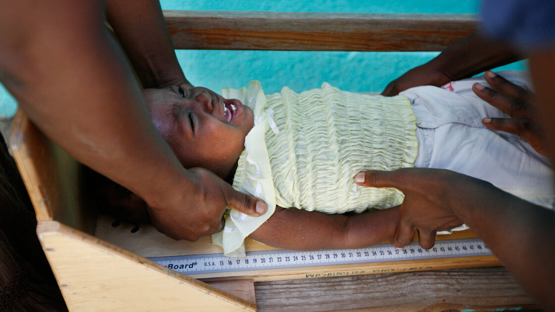 Renande Raphael, aged 16 months, is measured to check whether she is growing normally. As part of a new trial, she's receiving an extra daily snack of enriched peanut butter.