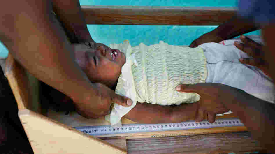 Renande Raphael, aged 16 months, is measured to check whether she is growing normally. As part of a new trial, she's receiving an extra daily snack of enriched peanut butter.