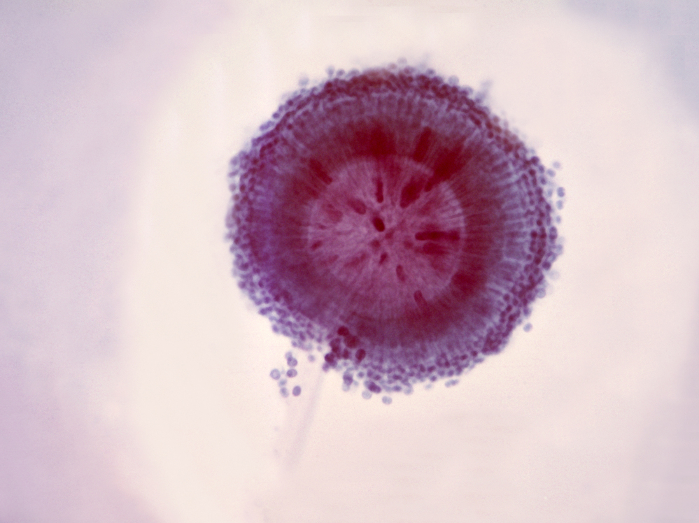The fungus Aspergillus niger shows up as a black mold on decaying vegetation and food.
