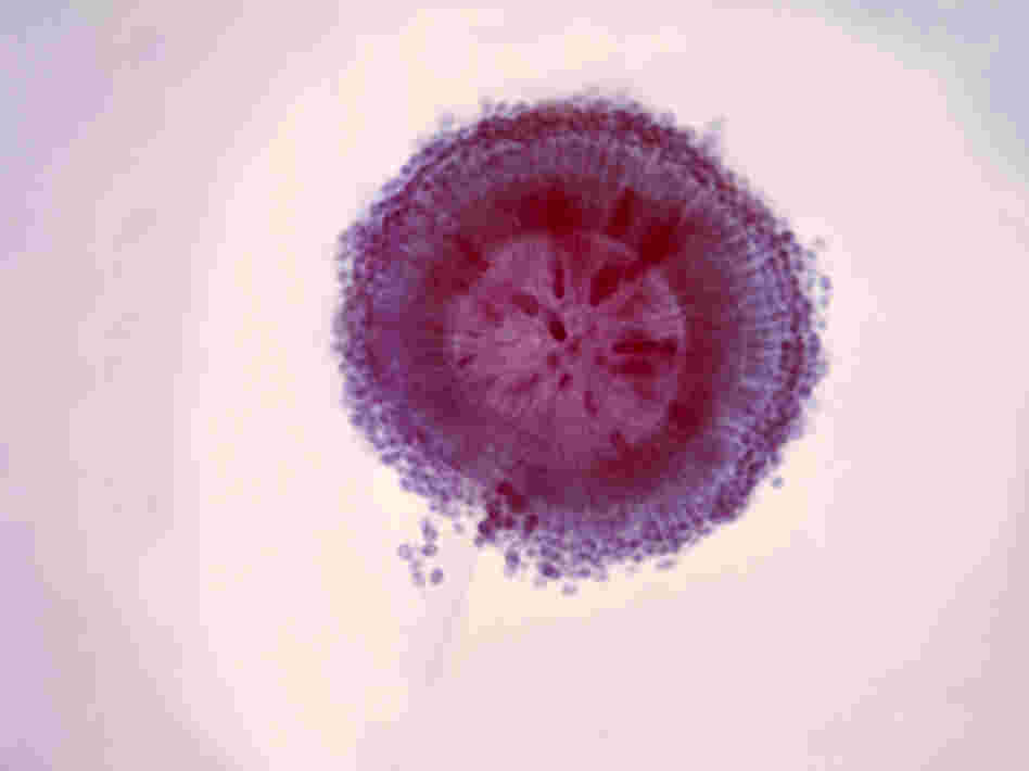 The fungus Aspergillus niger shows up as a black mold on decaying vegetation and food.