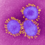 Different types of coronaviruses can cause a simple cold or a deadly respiratory illness, such as SARS.