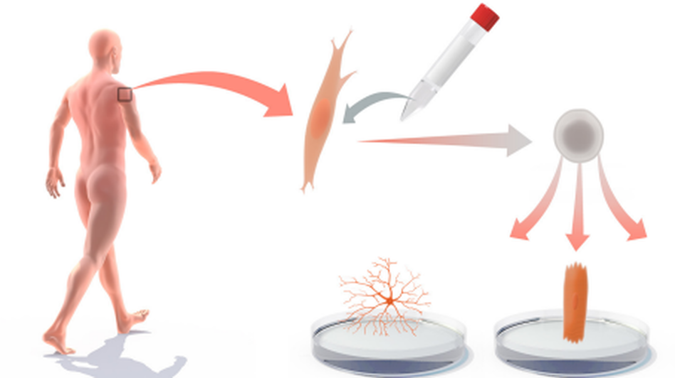 Shinya Yamanaka discovered a simple recipe for converting skin from a patient into many different cell types, including nerve and heart cells. Shinya Yamanaka discovered a simple recipe for converting skin from a patient into many different cell types, including nerve and heart cells.