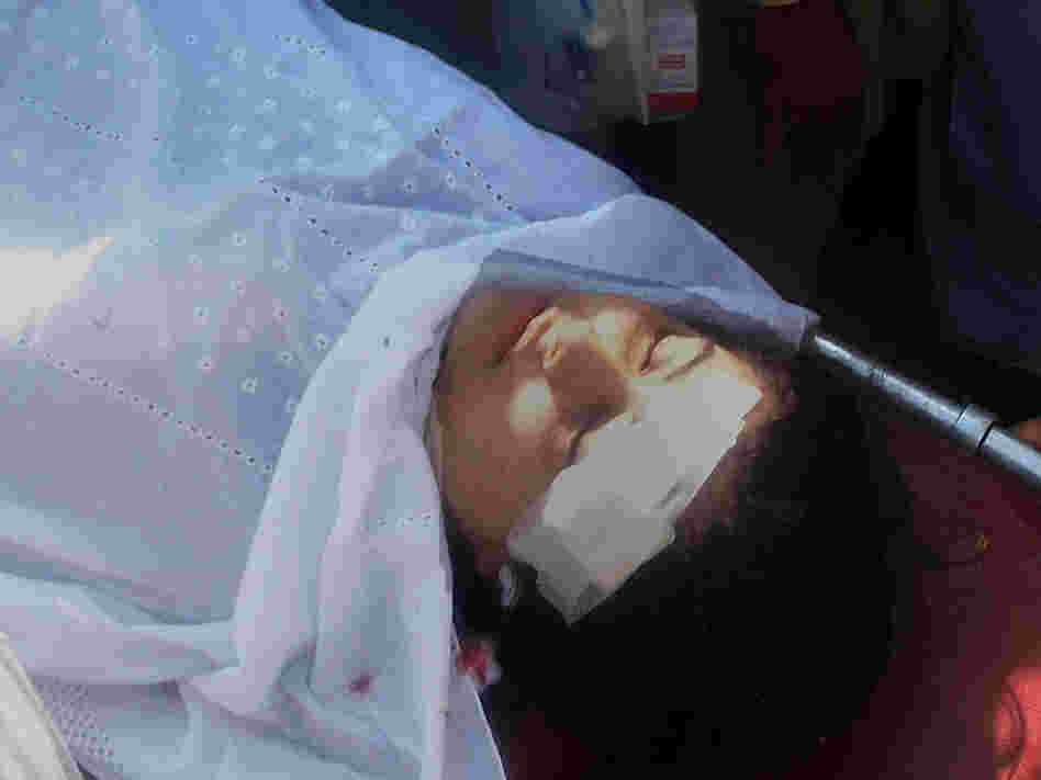 Malala Yousufzai on a stretcher as she was being taken to a hospital earlier today in Mingora, Pakistan.