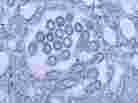 H1N1 virus virons appear in a tissue sample.