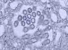 H1N1 virus virons appear in a tissue sample.