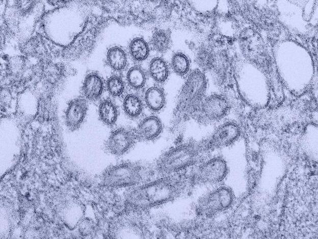 H1N1 virus virons appear in a tissue sample.