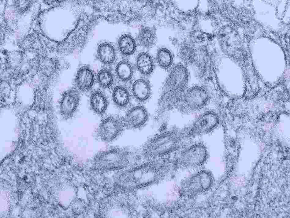 H1N1 virus virons appear in a tissue sample.