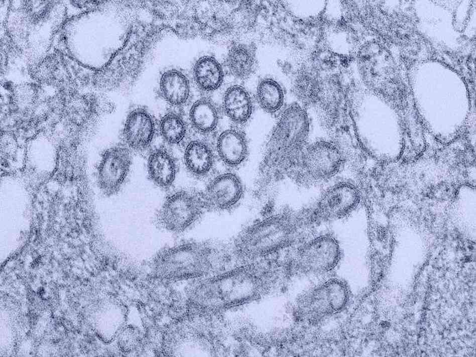 H1N1 virus virons appear in a tissue sample.