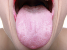 Scientists examined bacteria in the mouths of twins, and found that it's not as similar as they thought it would be. Scientists examined bacteria in the mouths of twins, and found that it's not as similar as they thought it would be.