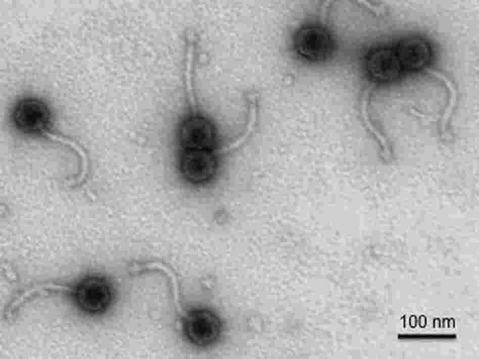 A tiny bacteriophage virus can cripple the bacteria that cause troublesome acne on teens' skin. A tiny bacteriophage virus can cripple the bacteria that cause troublesome acne on teens' skin.